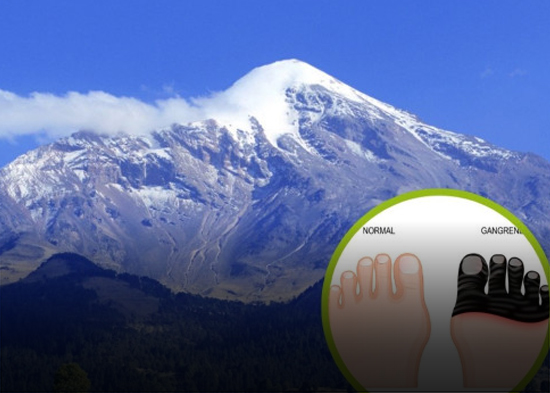 ¿Qué le pasa al cuerpo cuando subes el Pico de Orizaba? Alpinista rescatada podría perder sus manos